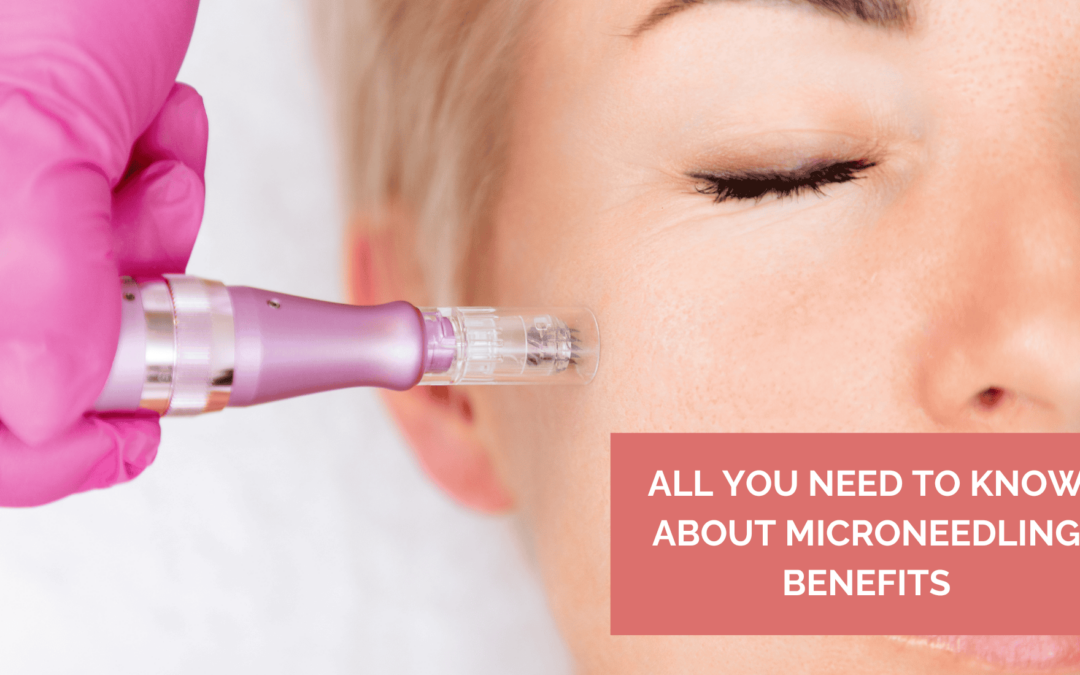 All You Need to Know About Microneedling Benefits
